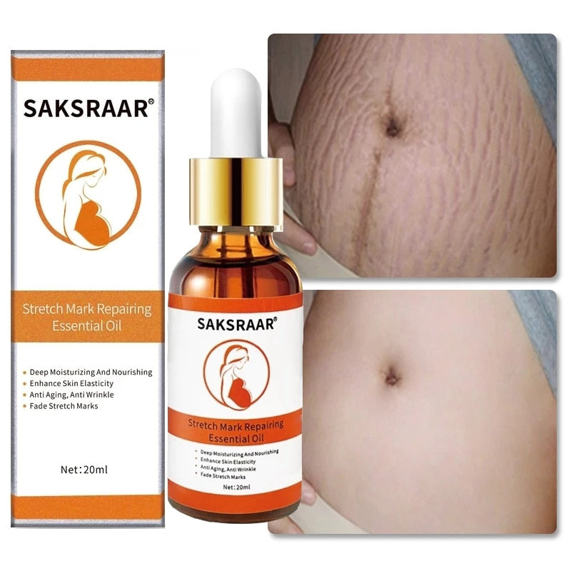 Stretch Marks Skin Care Treatment. Comes in essential oils and Cream For the Removal of stretch marks. Restores and replenishes the skin. - twobusybodies