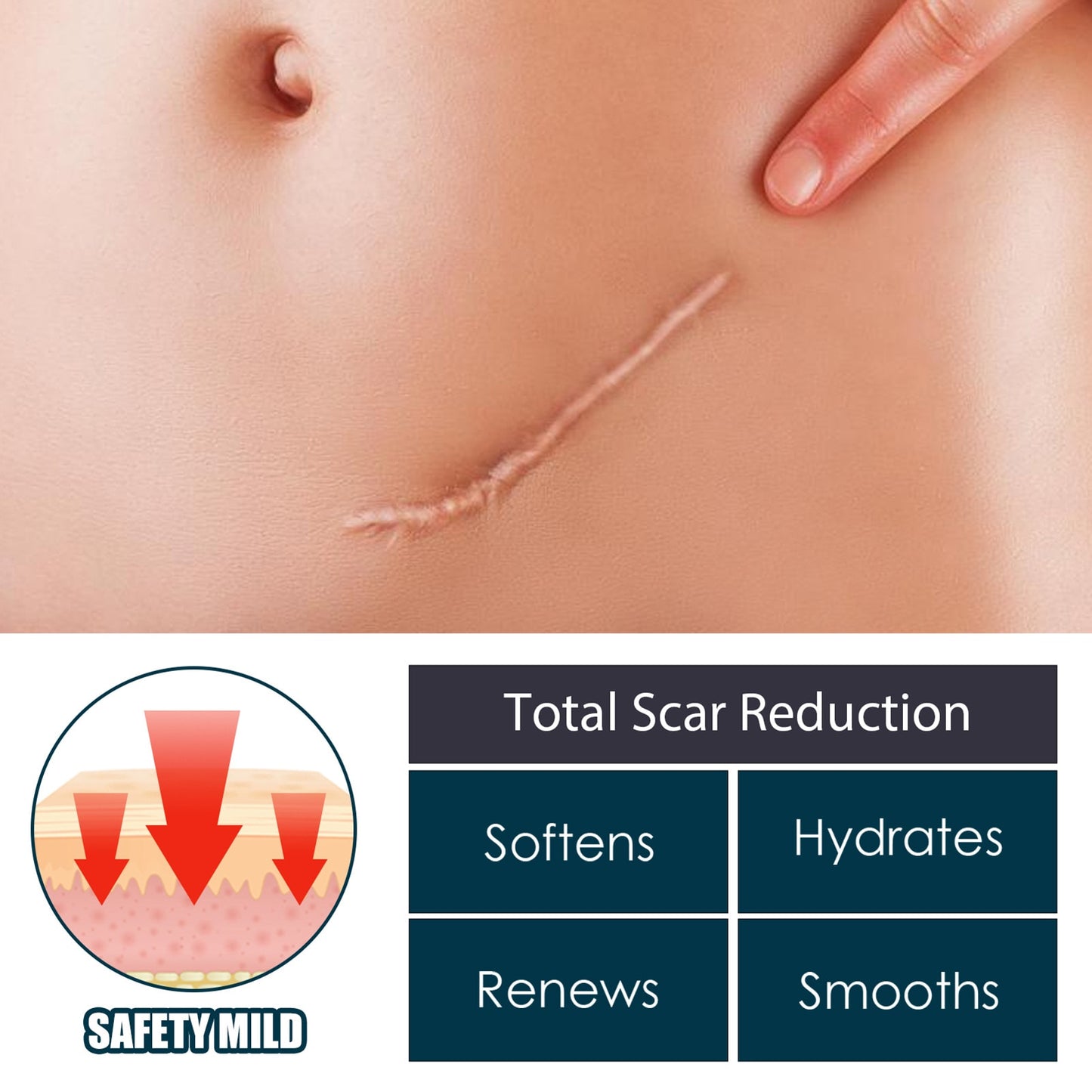 Scar Repair Gel