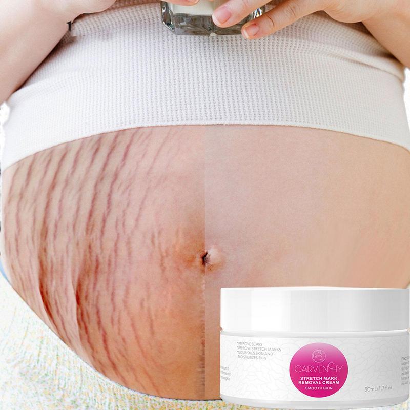 Postpartum Skin Care Cream